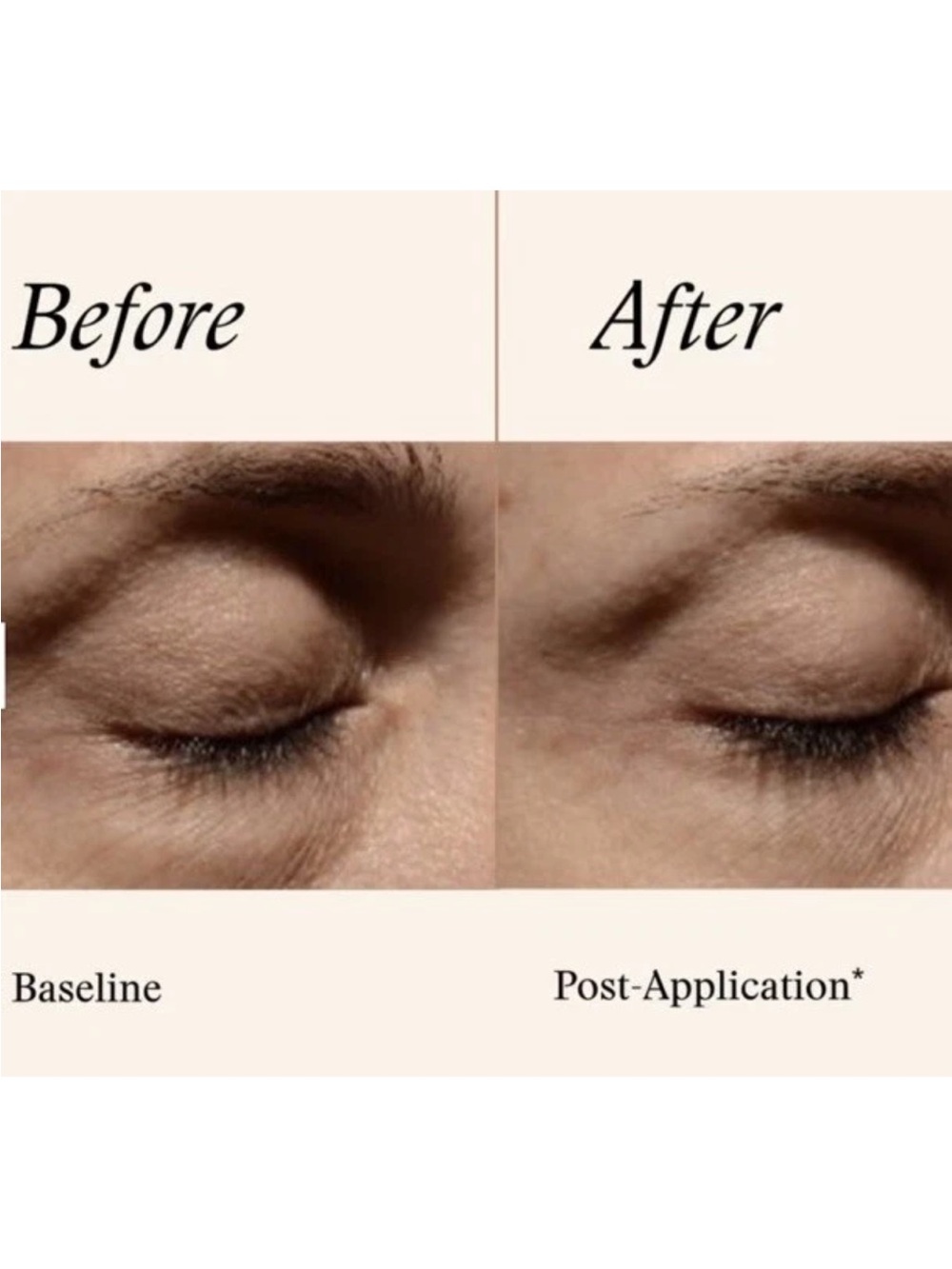 SkinMedica White & Gold Instant Bright Eye Cream - Picture 3 of 4